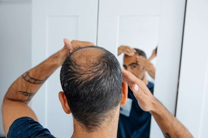 "Hair loss is a deeply personal issue that affects identity, yet the market is flooded with overpromising products that often leave consumers disappointed," said Andrew Black, Founder and Managing Partner of BrandProject. © agrobacter Getty Images